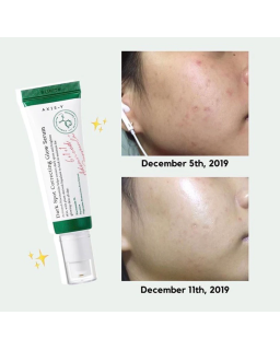AXIS-Y Dark Spot Correcting Glow Serum, 50ml