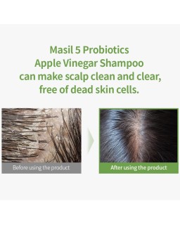 MASIL 5 PROBIOTICS APPLE VINEGAR SHAMPOO, 300ml
