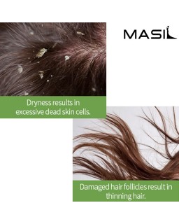 MASIL 5 PROBIOTICS APPLE VINEGAR SHAMPOO, 300ml
