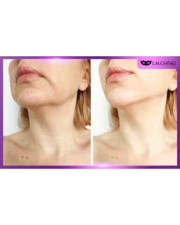 MEDIPEEL+ Premium 2.0 Collagen Naite Thread Neck Cream, 10g