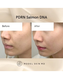 The booster gel offers a powerful combination of soothing and lifting properties.