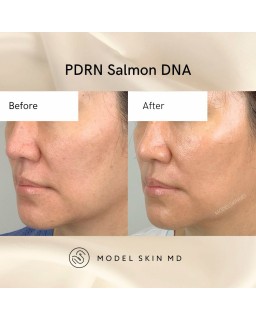 The booster gel offers a powerful combination of soothing and lifting properties.