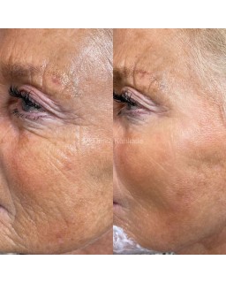 The booster gel offers a powerful combination of soothing and lifting properties.