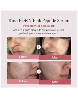 This anti-aging ampoule enriched with Salmon PDRN, salmon collagen complex and peptides improves skin elasticity, fades blemishe
