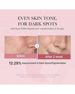 This anti-aging ampoule enriched with Salmon PDRN, salmon collagen complex and peptides improves skin elasticity, fades blemishe