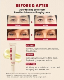 Lift under-eye bags and wrinkles with this powerful eye cream formulated with 4% retinal liposome along with soybean ferment ext