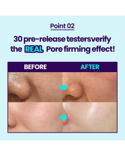 Experience the powerful effects of Pore-Jet Serum, infused with bakuchiol and proven to outperform retinol.