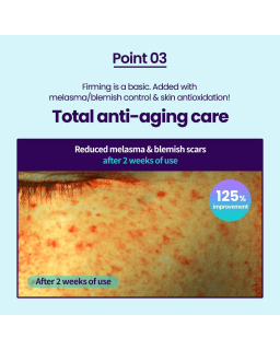 Experience the powerful effects of Pore-Jet Serum, infused with bakuchiol and proven to outperform retinol.