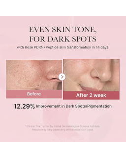 Glow boosting toner with rose pdrn that helps improve skin texture, while enhancing a natural glow.