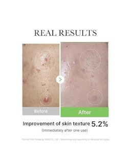 Repair and balance your skin with Medicube soothing serum, specifically designed for sensitive, dehydrated or irritation-prone