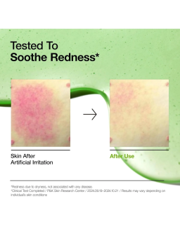 A lightweight serum formulated with soothing & hydrating ingredients, suitable for sensitive skin, helps improves redness