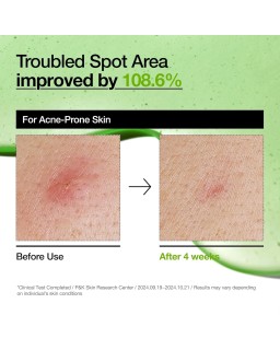 A lightweight serum formulated with soothing & hydrating ingredients, suitable for sensitive skin, helps improves redness