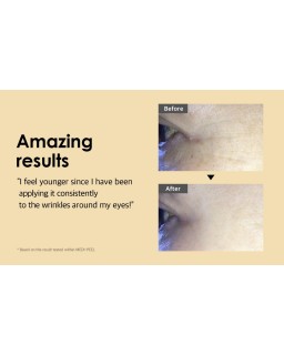 Eye cream that takes care of wrinkles around the eyes.