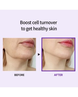 The cream is anti-aging cream that works faster and more effectively.