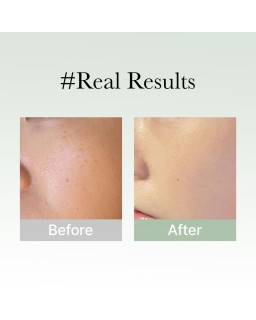 This gentle yet effective rich serum is suitable for all skin types, including sensitive skin, delivering powerful results