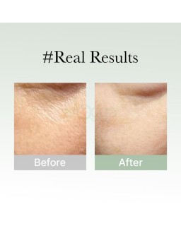 This gentle yet effective rich serum is suitable for all skin types, including sensitive skin, delivering powerful results