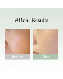 This gentle yet effective rich serum is suitable for all skin types, including sensitive skin, delivering powerful results witho