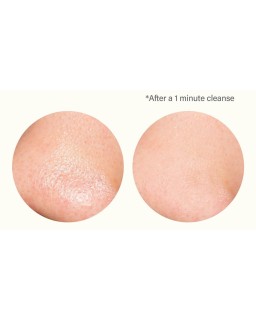 Purify skin with this blissfully blue cleanser that helps unclog pores and clear out blackheads.