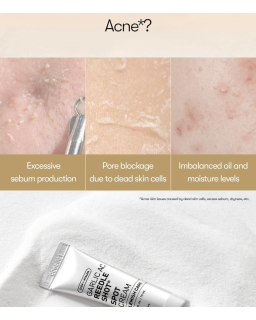 Intensive Acne Spot Cream - Quick Spot care Powered by Garlic Exosome helps sooth skin, clafiry pores.
