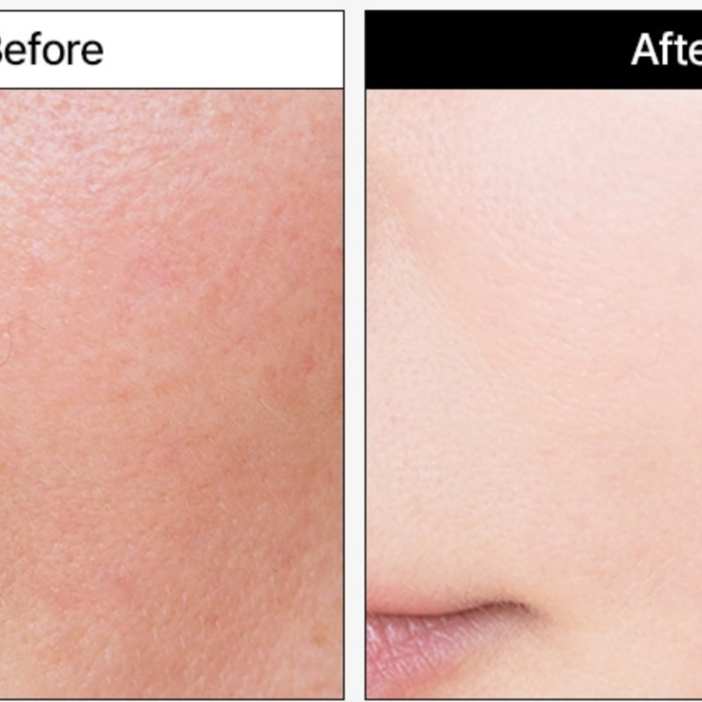 MEDIPEEL+ Phyto Cica Nol B5 Wrapping Mask, 70ml - Imagen 3