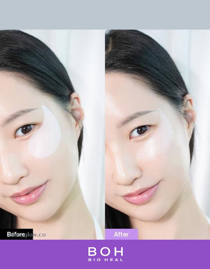 Bioheal BOH Probioderm Collagen Remodeling Eye Patch, 60ea - Imagen 4