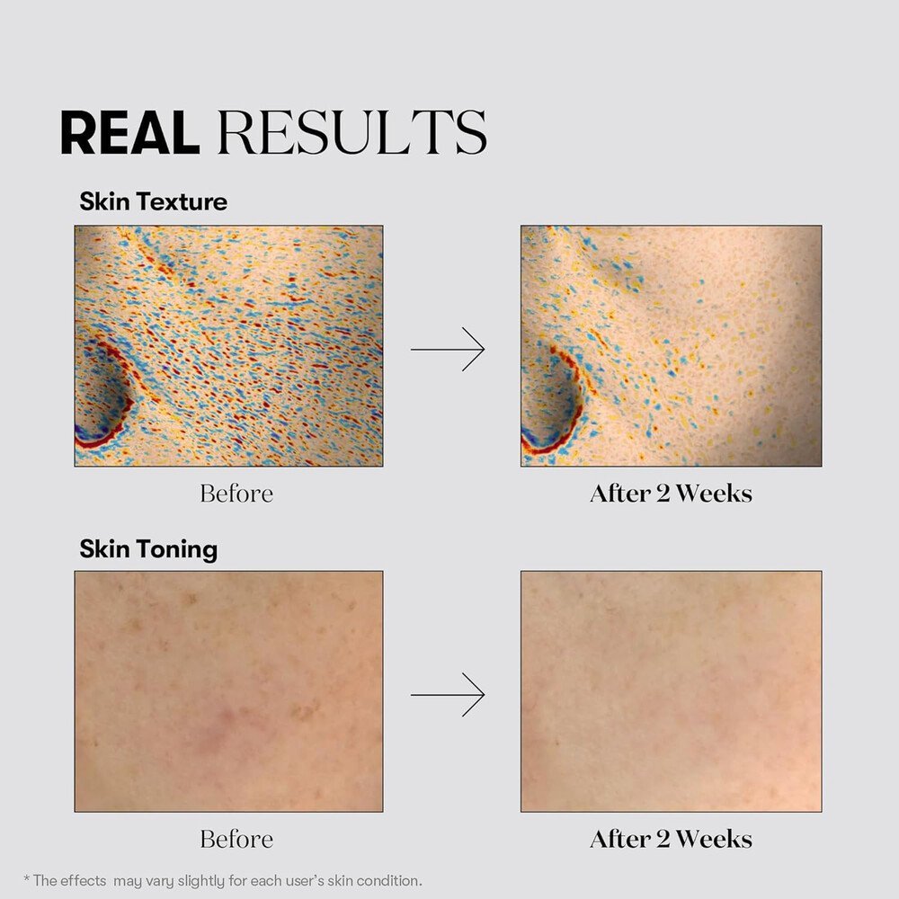 VT Cosmetics TX Toning Cream, 50ml - Imagen 3