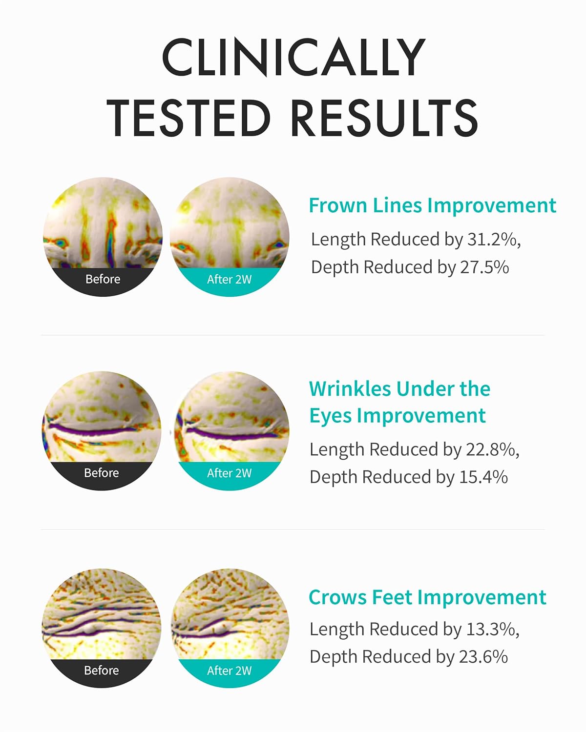 Rejuran Intensive Eye Cream, 20ml