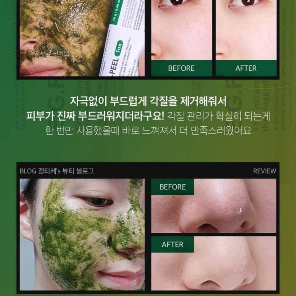 MEDIPEEL+ EGF-Peel Tox, 70g - Imagen 4