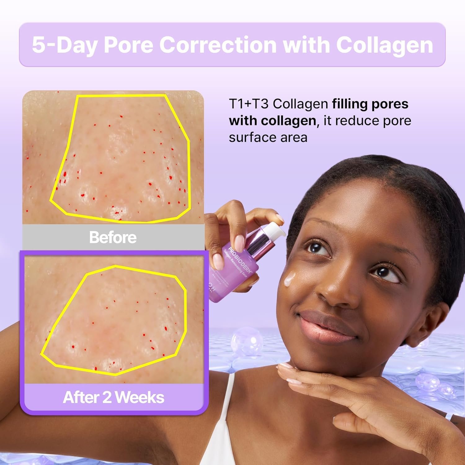 Bioheal BOH Probioderm Collagen Remodeling Serum, 30ml - Image 4
