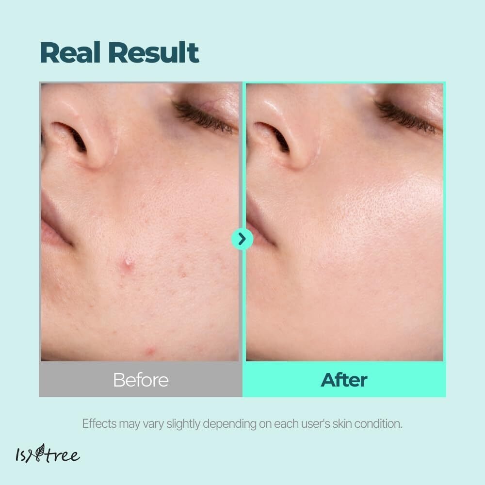 Isntree GIM PDRN Deep Sleep Mask, 80ml - Imagen 5