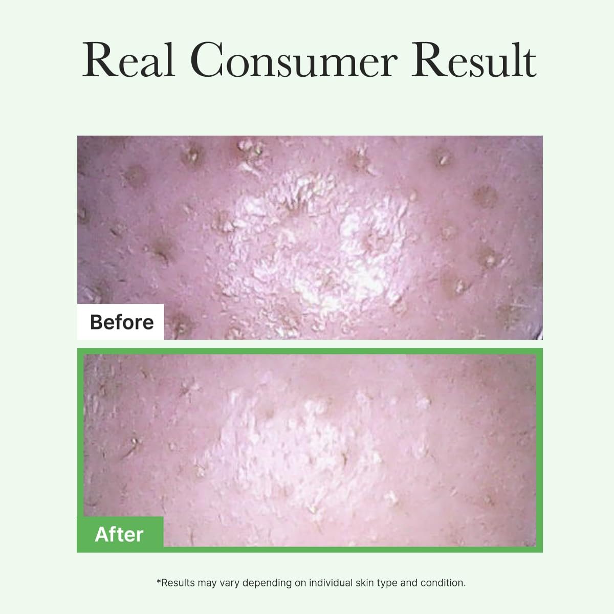 Arencia Pore Melt Mochi Cleansing Oil, 200ml - Image 7