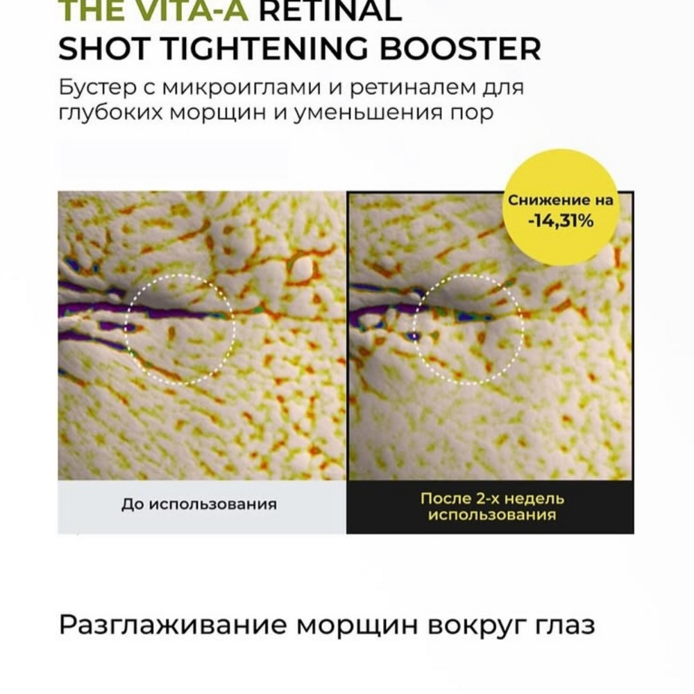 CELIMAX The Vita-A Retinal Shot Tightening Booster, 15ml - Image 8