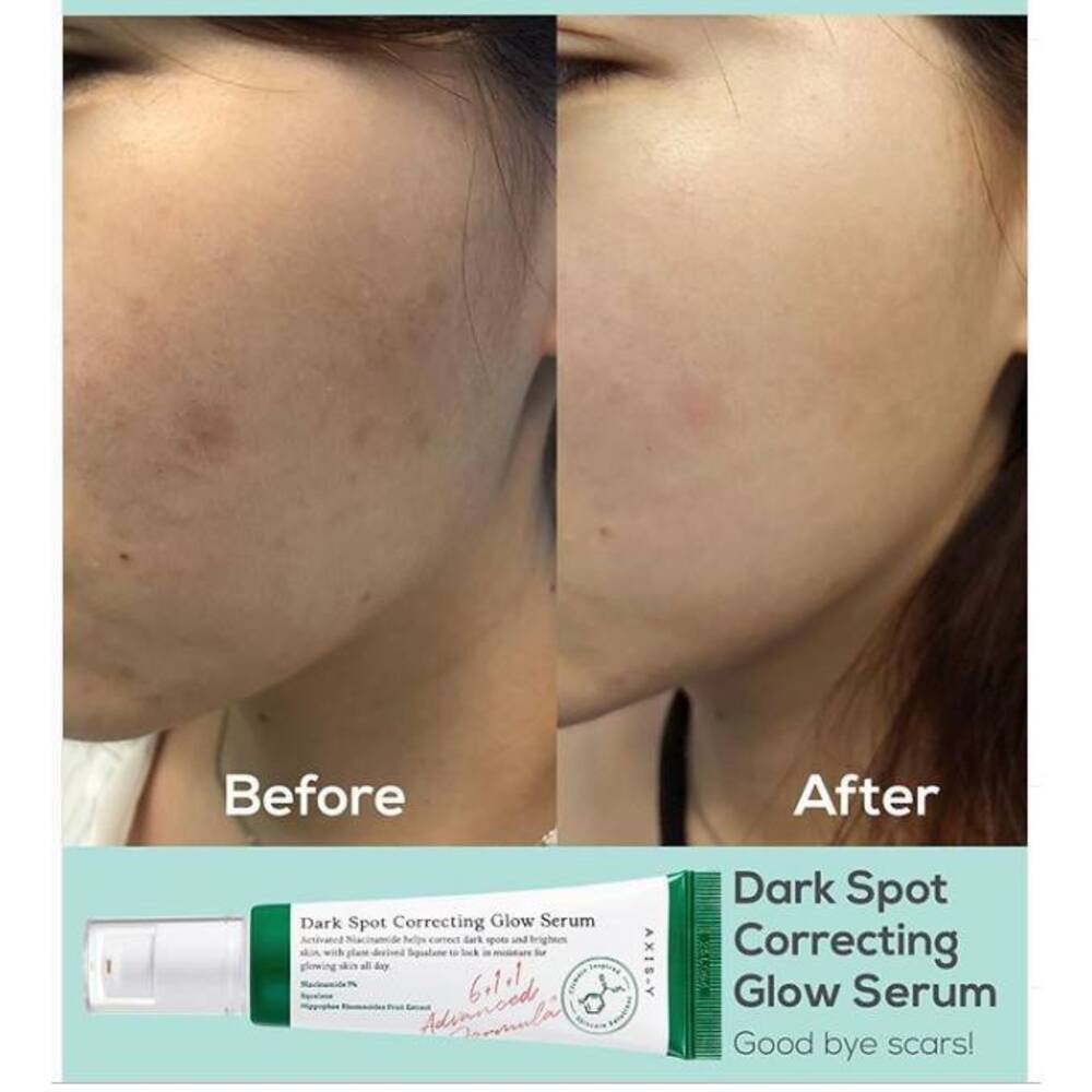 Axis-Y Dark Spot Correcting Glow Serum, 50ml (2026.06.12) — изображение 3