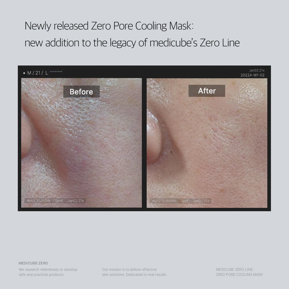 Medicube Zero Pore Cooling Mask - Imagen 4
