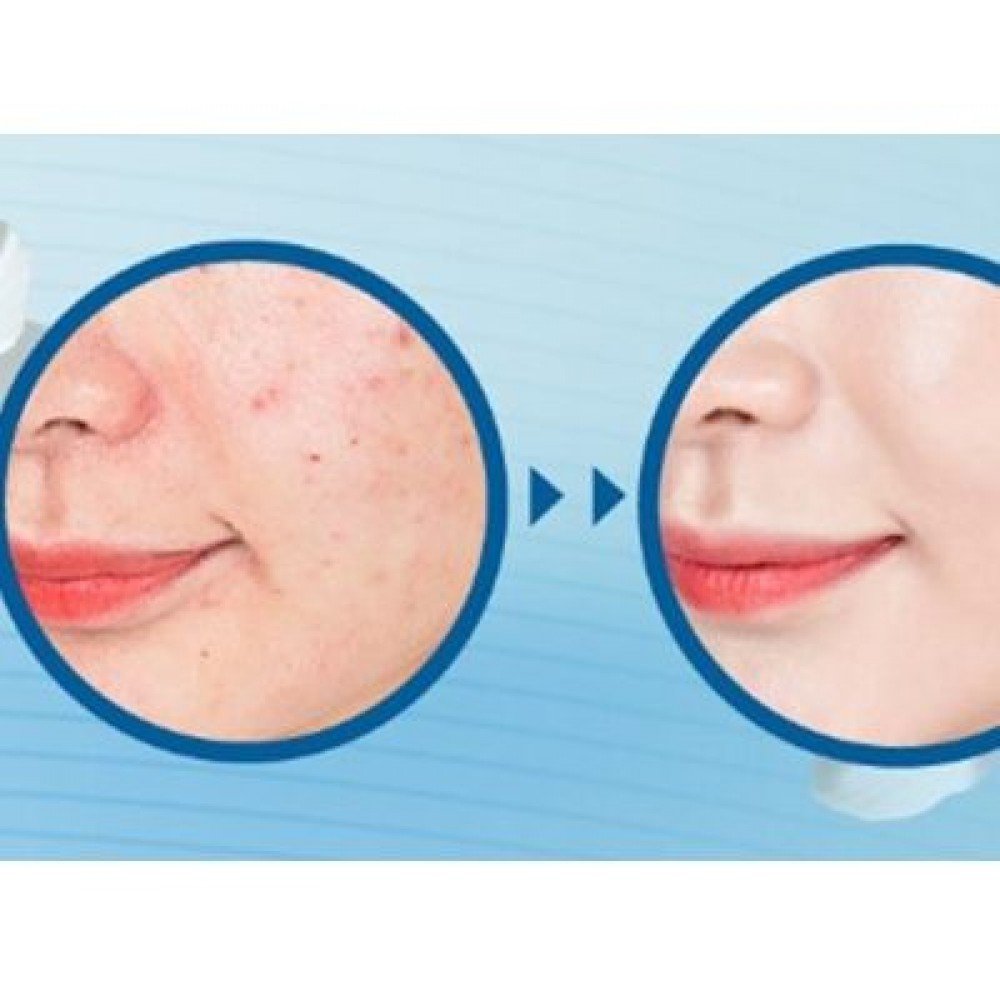 CU Skin Clean-Up Skinfit Cushionpact No.21 SPF50 PA+++, 15g+15g - Imagen 4