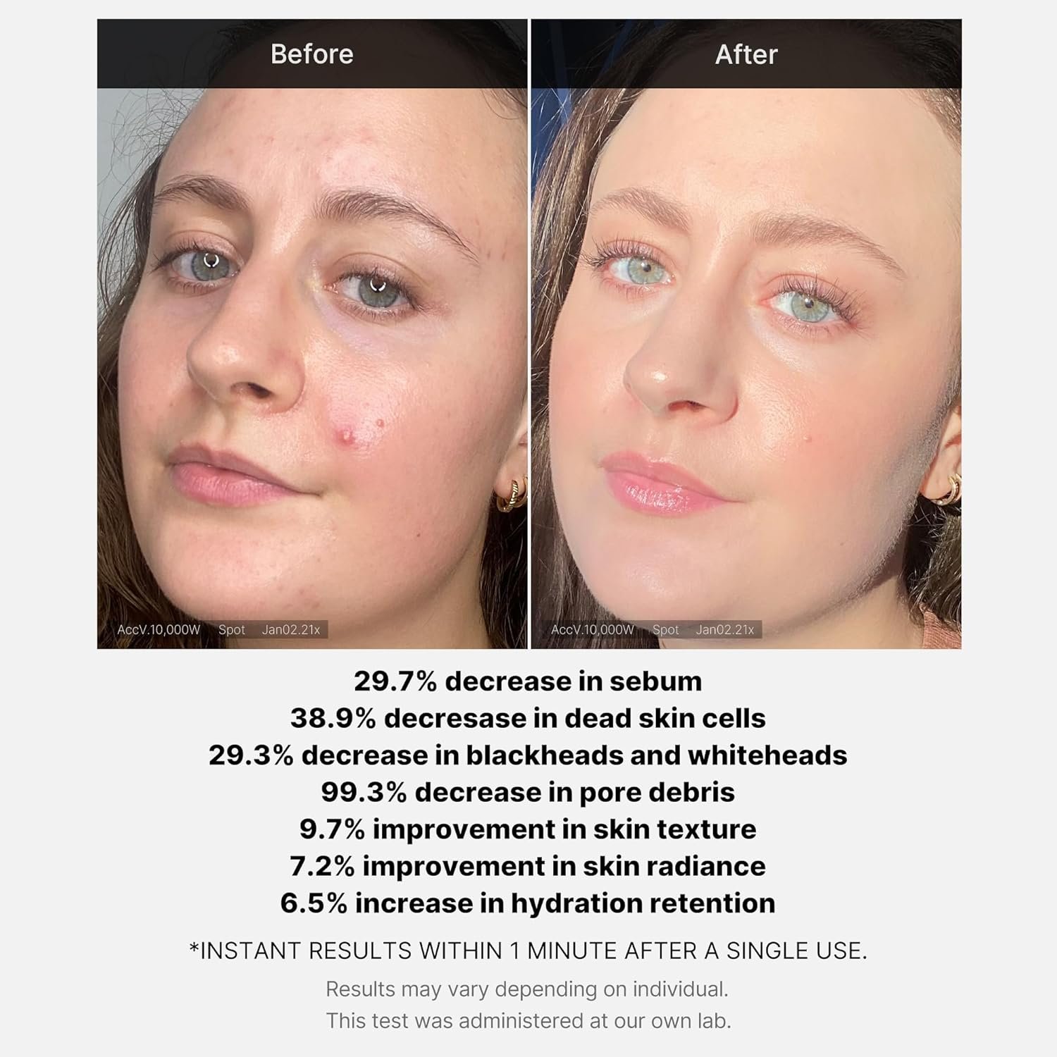 Medicube Red Acne Succinic Acid Peel, 40g - Imagen 5
