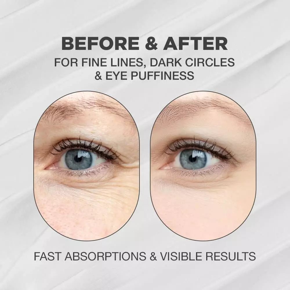 3W Clinic Snail Eye Cream, Anti-Wrinkle, 40ml - Imagen 3