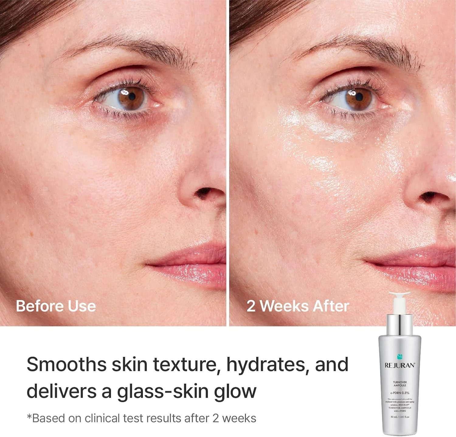 Rejuran Turnover Ampoule, 50ml — изображение 3